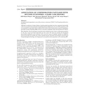 Comparison of The Adverse Effects of Tofacitinib with Narrowband Ultraviolet B Phototherapy in the Treatment of Vitiligo